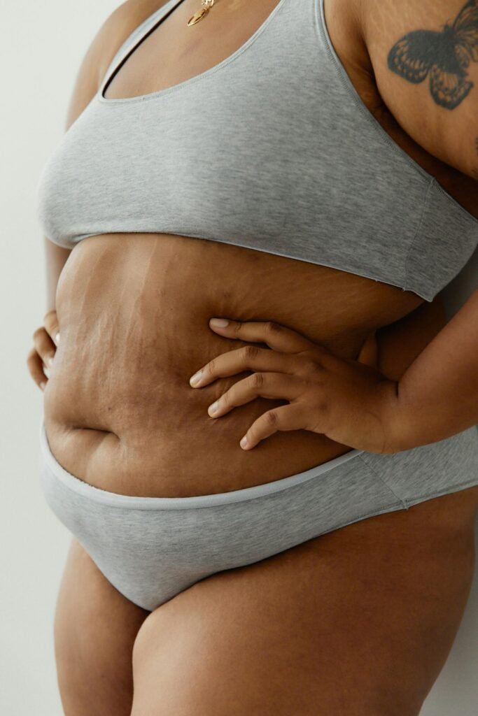 O Que é Obesidade? Causas, Sintomas e Como Identificar o Problema